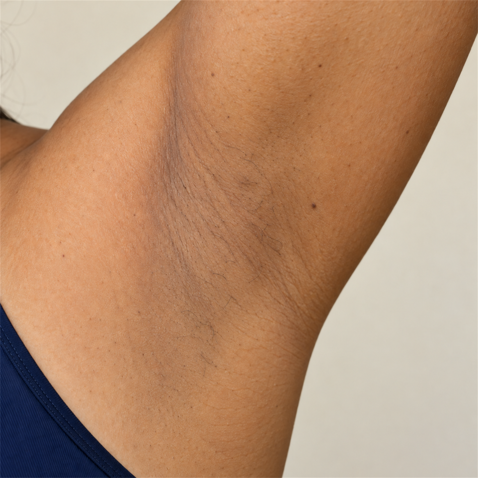 Armpit Area after