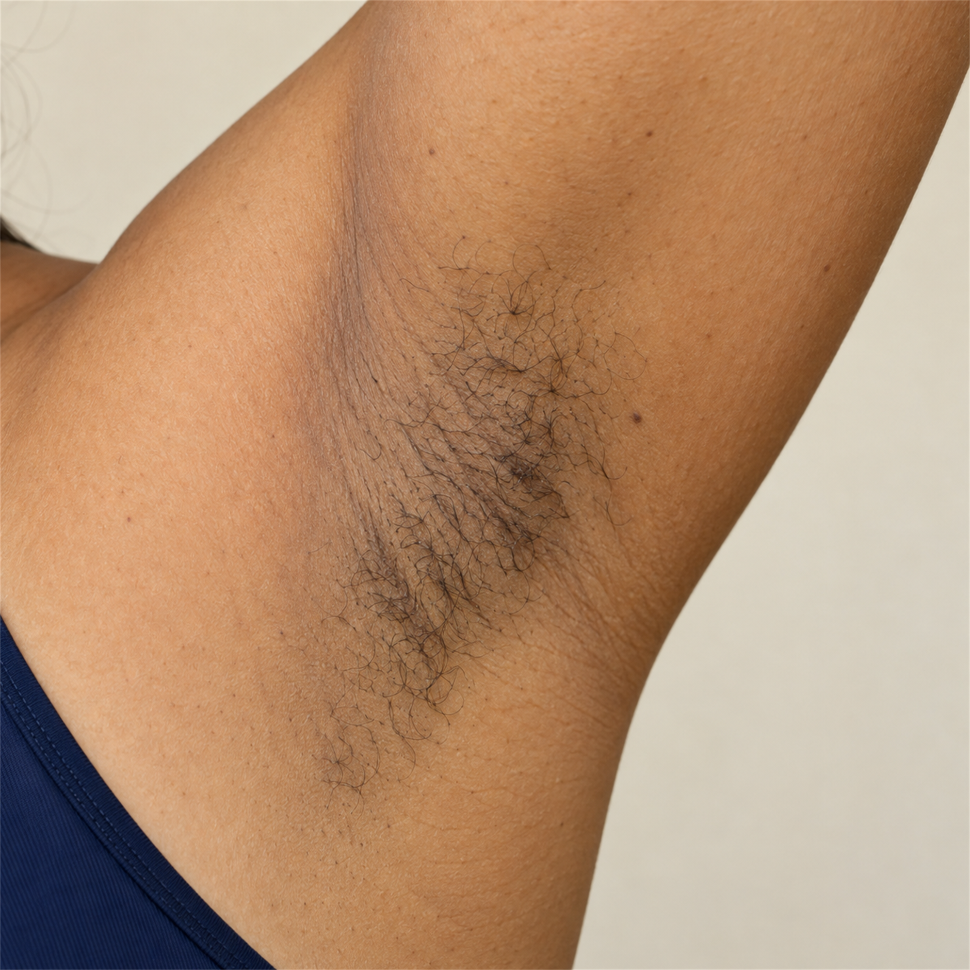 Armpit Area before